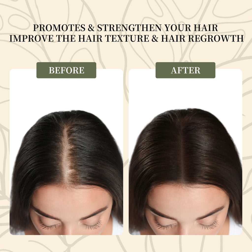Batana Oil for Hair Growth, Pure Natural Raw Oil from Honduras, 4.2oz X5252