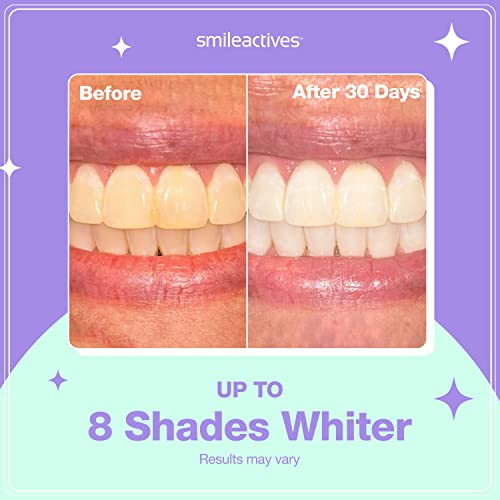 Teeth Whitening Kit with Toothpaste, Gel, and Whitening Pen M320