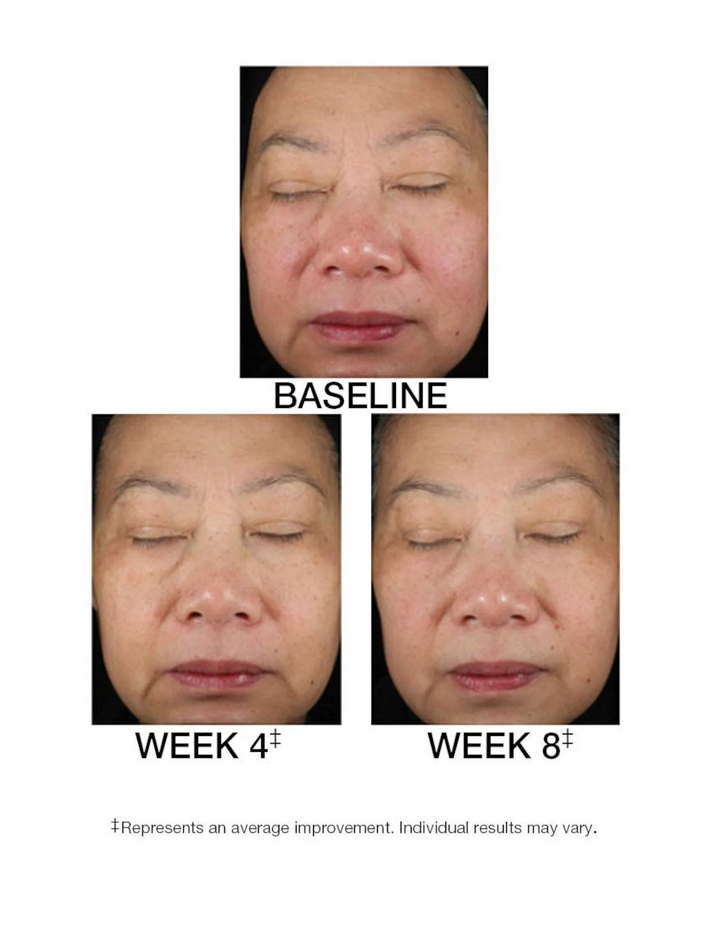 Replenishing Serum C+E 1.5 fl oz P8515